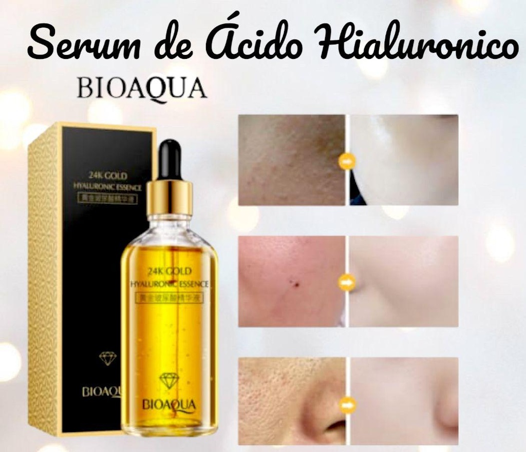 ESENCIA DE ÁCIDO HIALURÓNICO DE ORO